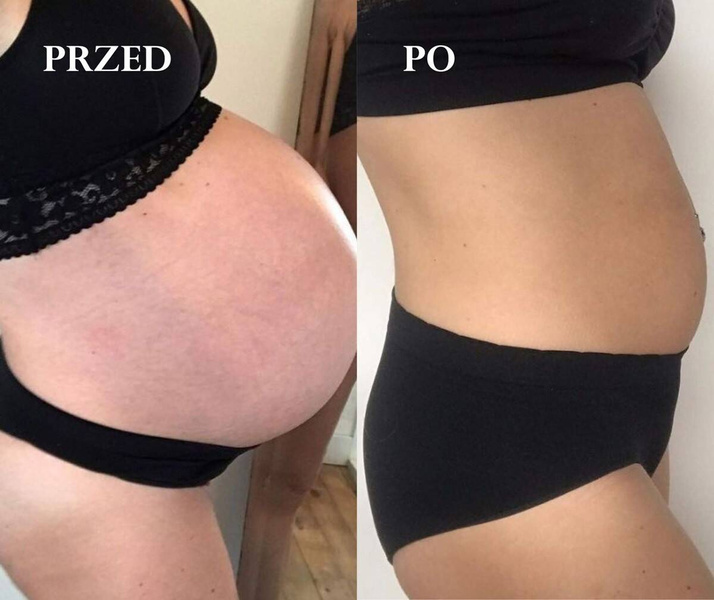 Suchy olejek do ciała zapobiegający rozstępom, dla kobiet w ciąży i karmiących, OBDAROWANA, Cosmebio, 100 ml, Omum